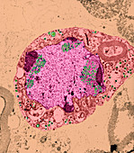 Herpes Simplex Virus,TEM