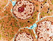 Leydig Cells,TEM