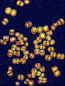 Neisseria meningitidis bacteria,LM