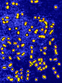 Streptococcus pneumoniae bacteria,LM
