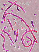 Streptococcus bacteria,LM