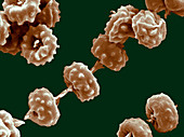 Aspergillus acidus spores by SEM