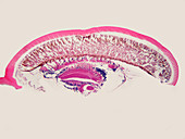 Insect Eye,LM