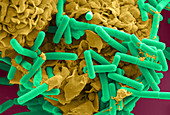 E. coli and Macrophage (SEM)