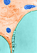 TEM of Adipose Cells