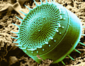 Freshwater Diatom,SEM