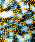 Yellow Fever Virus,TEM