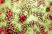 Hepatitis-B Virus,TEM
