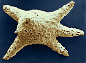 Baculogypsina sphaerulata (SEM)