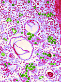 Group C RNA tumour virus particles,TEM