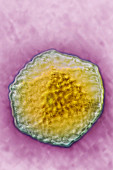 Hepatitis A Virus (HAV)