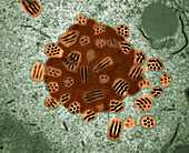 TEM of Baculovirus