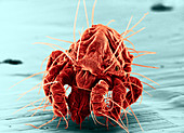 Red Spider Mite,SEM