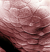 Human Bladder,SEM