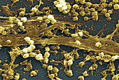 Staphylococcus aureus Bacteria,SEM