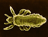 Human Head Louse,SEM