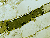 Banyan Fig,Laticifer Cell (TEM)