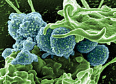 Staphylococcus aureus Bacteria,MRSA,SEM