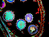 Pollen Grains in Cotton,Gossypium,LM
