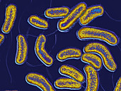 Vibrio Cholera Bacilli,LM