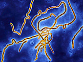 Ebola Virus,TEM
