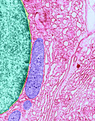 Nuclear Membrane,TEM