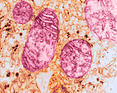 Mitochondria and Endoplasmic Reticulum