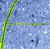 Cell Division in Stonewort,TEM