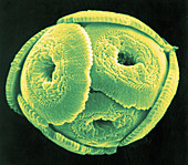 Reticulofenestra pseudoumbilica Algae