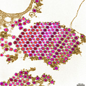 TEM of Chikungunya Virus