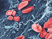 Blood Platelets and Red Blood Cell,SEM