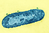 E. coli Infected with Bacteriophage,TEM