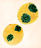 Mitosis in Trillium Cell,LM