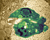 Trypanosoma Cruzi,TEM