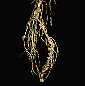 Bean Root Nodules