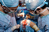 Brain tumour surgery