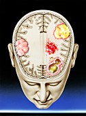 Causes of aphasia,illustration