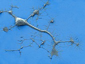 Stem cell-derived neuron,SEM