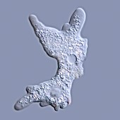 Deuteramoeba amoeba,LM