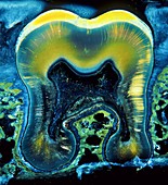 Human tooth,light micrograph