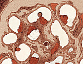 Kidney glomerulus,TEM