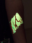 Arm veins shown by infrared finder