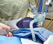 Ventilating a tracheostomy patient