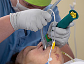 General anaesthesia intubation