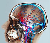 Normal brain blood supply,CT scan