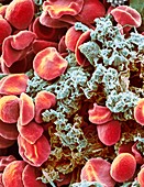 Red blood cells and platelets,SEM