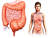 Human mega colon,illustration
