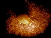 Dust mite