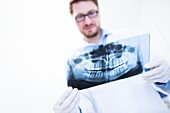 Dentist holding x-ray