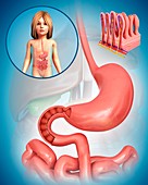 Child's duodenum,illustration